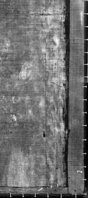 Fig. 6 Lower right detail of the X-ray showing flattened original tacking edge and added strips B and C